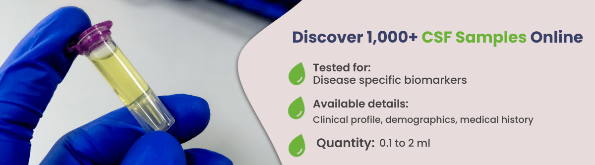 Banner CSF Samples For Discovery and Diagnostics