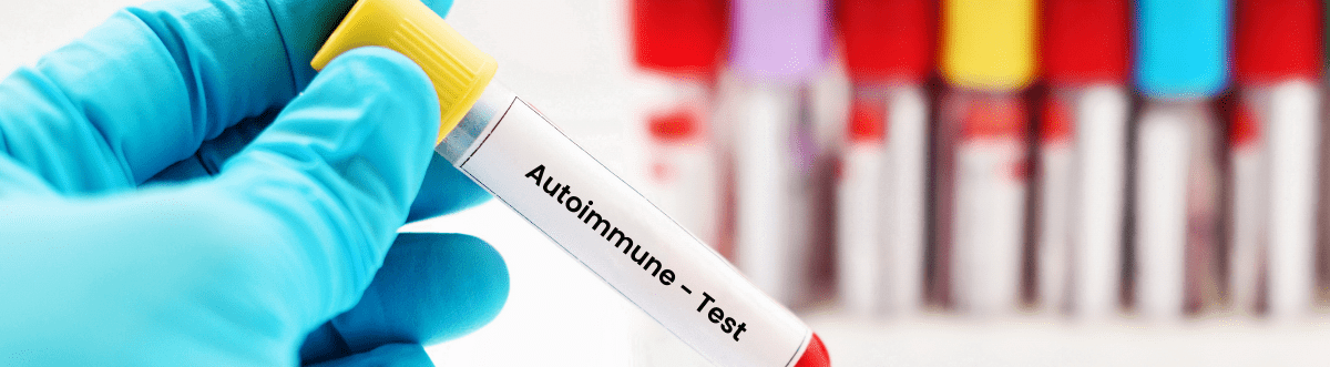 Banner Explore our latest Autoimmune Inventory Update